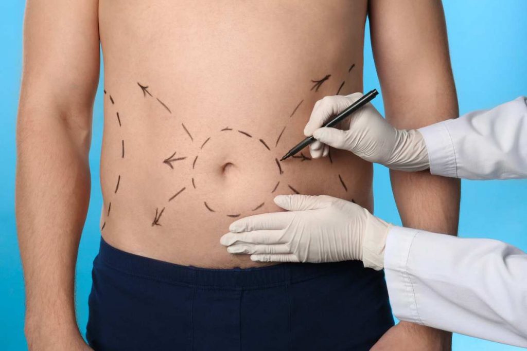 Chirurgia estetica per uomini